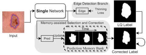 Learning a Single Network for Robust Medical Image Segmentation With Noisy Labels